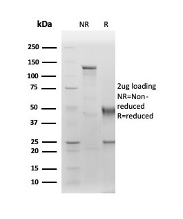 SDS-PAGE Analysis of Purified Albumin Recombinant Rabbit Monoclonal Antibody (ALB/6411R). Confirmation of Purity and Integrity of Antibody.