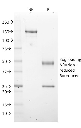 SDS-PAGE Analysis Purified EZH2 / KMT6 Mouse Monoclonal Antibody (EZH2/2536). Confirmation of Purity and Integrity of Antibody.
