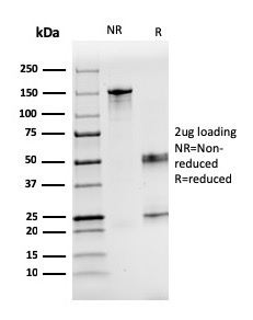 SDS-PAGE Analysis  Purified Coagulation Factor VII Mouse Monoclonal Antibody (F7/3516). Confirmation of Integrity and Purity of Antibody.