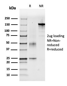 SDS-PAGE Analysis of Purified Coagulation Factor VII Mouse Monoclonal Antibody (F7/3618). Confirmation of Integrity and Purity of Antibody.