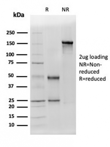SDS-PAGE Analysis Purified ALDH1A1 Mouse Monoclonal Antibody (ALDH1A1/4793). Confirmation of Integrity and Purity of Antibody.