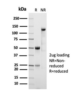 SDS-PAGE Analysis Purified ALDH1A1 Recombinant Rabbit Monoclonal (ALDH1A1/7011R). Confirmation of Integrity and Purity of Antibody.