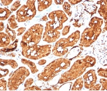Formalin-fixed, paraffin-embedded human kidney stained with ALDH1A1 Recombinant Rabbit Monoclonal Antibody (ALDH1A1//7011R). HIER: Tris/EDTA, pH9.0, 45min. 2 °: HRP-polymer, 30min. DAB, 5min.