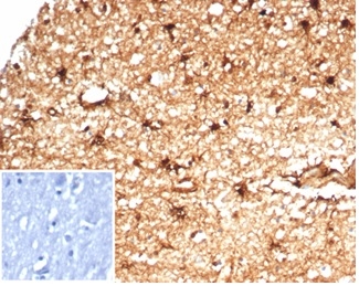 Formalin-fixed, paraffin-embedded human brain stained with ALDH1A1 Recombinant Rabbit Monoclonal Antibody (ALDH1A1/7011R). Inset: PBS instead of primary antibody; secondary only negative control.