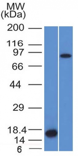 Western Blot Analysis of Recombinant Protein and HeLa cell lysate using Factor XIIIa Mouse Monoclonal Antibody (F13A1/1448).