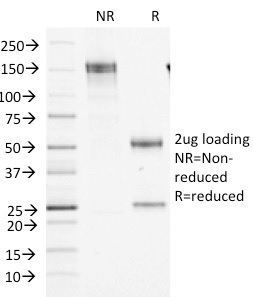 SDS-PAGE Analysis of Purified Factor XIIIa Mouse Monoclonal Antibody (F13A1/1448). Confirmation of Integrity and Purity of Antibody.