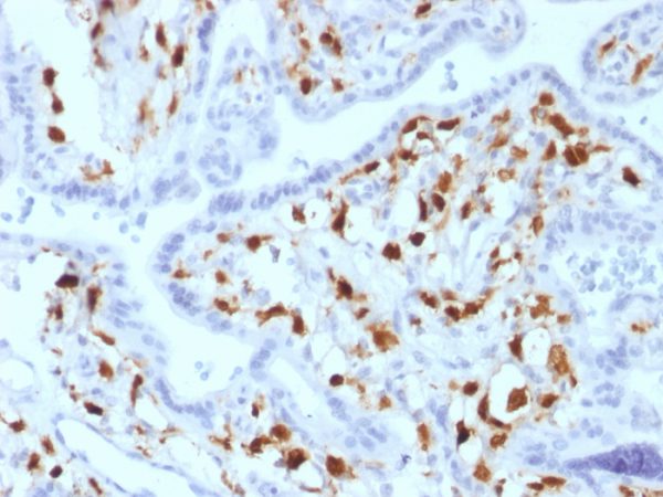 Formalin-fixed, paraffin-embedded human Placenta stained with Factor XIIIa Mouse Monoclonal Antibody (SPM180).