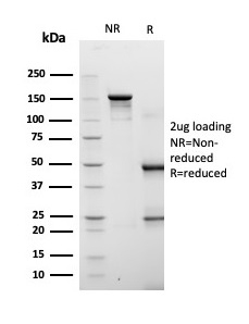 SDS-PAGE Analysis of Purified FABP4 Mouse Monoclonal Antibody (FABP4/4422). Confirmation of Purity and Integrity of Antibody.
