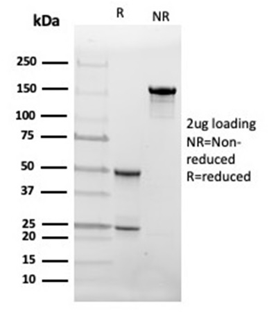 SDS-PAGE Analysis Purified FABP4 Mouse Monoclonal Antibody (FABP4/4426). Confirmation of Purity and Integrity of Antibody.
