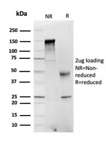 SDS-PAGE Analysis of Purified FABP1 Mouse Monoclonal Antibody (FABP1/3484). Confirmation of Purity and Integrity of Antibody.