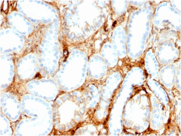 Formalin-fixed, paraffin-embedded human kidney stained with FABP1 Mouse Monoclonal Antibody (FABP1/3486).