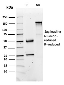 SDS-PAGE Analysis of Purified FABP1 Mouse Monoclonal Antibody (FABP1/3486). Confirmation of Purity and Integrity of Antibody.