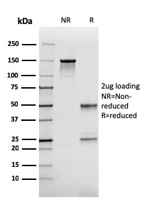 SDS-PAGE Analysis of Purified FABP2 Mouse Monoclonal Antibody (CPTC-FABP2-3). Confirmation of Purity and Integrity of Antibody.