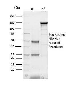 SDS-PAGE Analysis of Purified FABP3 Mouse Monoclonal Antibody (FABP3/3430). Confirmation of Purity and Integrity of Antibody.