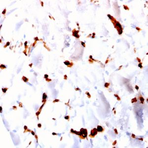 Formalin-fixed, paraffin-embedded human skeletal muscle stained with FABP5 Mouse Monoclonal Antibody (CPTC-FABP5-3).