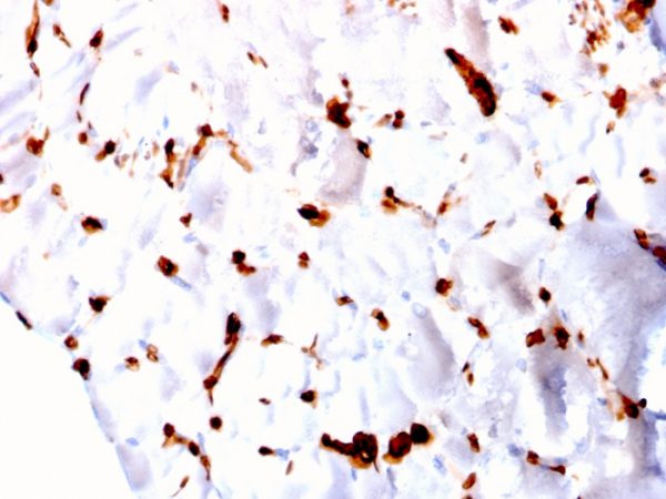 Formalin-fixed, paraffin-embedded human skeletal muscle stained with FABP5 Mouse Monoclonal Antibody (CPTC-FABP5-3).