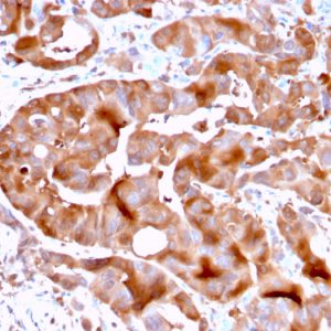 Formalin-fixed, paraffin-embedded human Liver tissue stained with FABP5 Mouse Monoclonal Antibody (FABP5/3750).