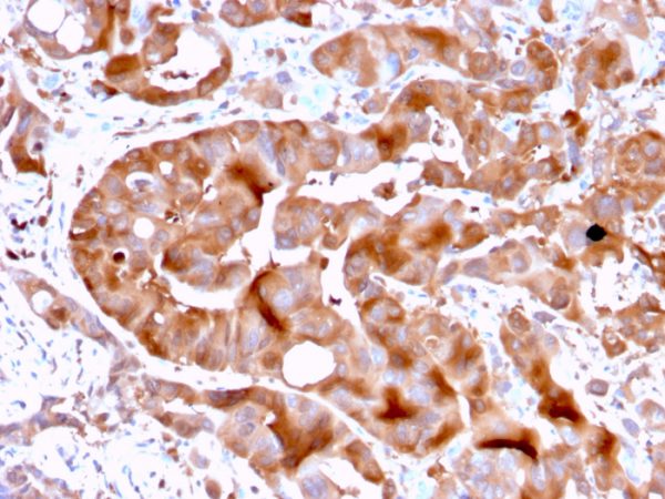 Formalin-fixed, paraffin-embedded human Liver tissue stained with FABP5 Mouse Monoclonal Antibody (FABP5/3750).