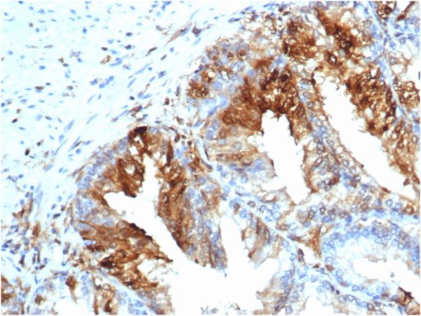 Formalin-fixed, paraffin-embedded human skeletal muscle stained with FABP5 Recombinant Mouse Monoclonal Antibody (rFABP5/6354).