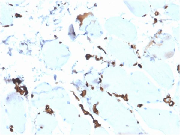 Formalin-fixed, paraffin-embedded human esophagusstained with FABP5 Recombinant Mouse Monoclonal Antibody (rFABP5/6354).