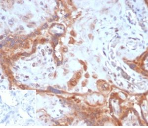 Formalin-fixed, paraffin-embedded human placenta stained with Fibroblast Activation Protein Mouse Monoclonal Antibody (FAP/4851). Inset: PBS instead of primary antibody, secondary only negative control.