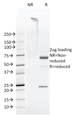 SDS-PAGE Analysis of Purified FAT Mouse Monoclonal Antibody (FAT1-3D7/1). Confirmation of Purity and Integrity of Antibody.