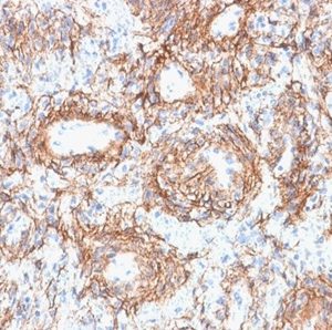 Formalin-fixed, paraffin-embedded human kidney stained with Fibrillin 1 Mouse Monoclonal Antibody (FBN1/2191). HIER: Tris/EDTA, pH9.0, 45min. 2 °: HRP-polymer, 30min. DAB, 5min.