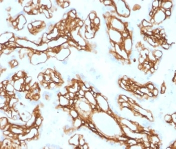 Formalin-fixed, paraffin-embedded human placenta stained with Fibrillin 1 Mouse Monoclonal Antibody (FBN1/2191). HIER: Tris/EDTA, pH9.0, 45min. 2°C: HRP-polymer, 30min. DAB, 5min.
