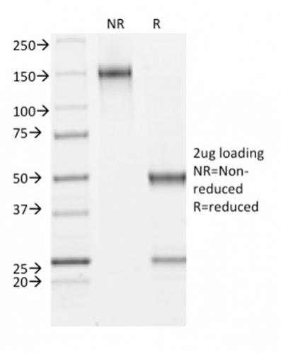 SDS-PAGE Analysis of Purified Fibrillin-1 Mouse Monoclonal Antibody (FBN1/2191). Confirmation of Integrity and Purity of Antibody.