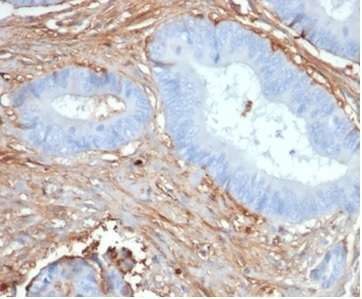 Formalin-fixed, paraffin-embedded human prostate stained with Fibrillin 1 Mouse Monoclonal Antibody (FBN1/6933). HIER: Tris/EDTA, pH9.0, 45min. 2°C: HRP-polymer, 30min. DAB, 5min.