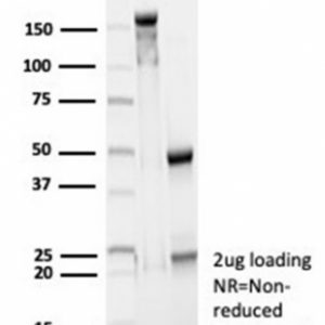 SDS-PAGE Analysis Purified CD23 Mouse Monoclonal Antibody (FCER2/6890). Confirmation of Purity and Integrity of Antibody.