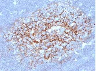 IHC analysis of formalin-fixed, paraffin-embedded human lymph node. Membrane stained using FCER2/6891 at 2ug/ml in PBS for 30min RT. HIER: Tris/EDTA, pH9.0, 45min. 2°C: HRP-polymer, 30min. DAB, 5min.