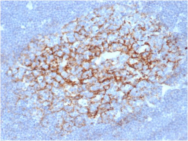 IHC analysis of formalin-fixed, paraffin-embedded human lymph node. Membrane stained using FCER2/6892 at 2ug/ml in PBS for 30min RT. HIER: Tris/EDTA, pH9.0, 45min. 2 °: HRP-polymer, 30min. DAB, 5min.
