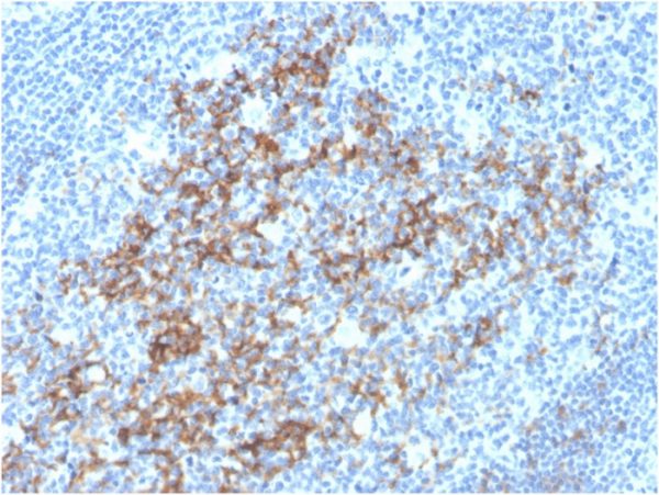 Formalin-fixed, paraffin-embedded human tonsil stained with Biotin-conjugated CD23 Mouse Monoclonal Antibody (FCER2/3592).