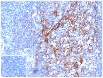 IHC analysis of formalin-fixed, paraffin-embedded human tonsil. Membrane staining using FCER2/6887 at 2ug/ml in PBS for 30min RT. Inset: PBS instead of primary antibody; secondary only negative control.