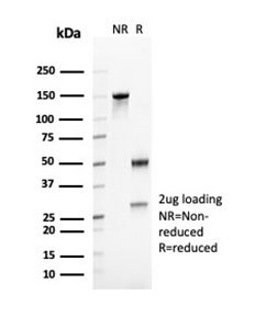 SDS-PAGE Analysis of Purified CD23 Mouse Monoclonal Antibody (FCER2/6888). Confirmation of Purity and Integrity of Antibody.