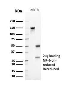 SDS-PAGE Analysis of Purified CD23 Mouse Monoclonal Antibody (FCER2/6888). Confirmation of Purity and Integrity of Antibody.