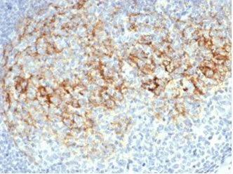 IHC analysis of formalin-fixed, paraffin-embedded human lymph node. Membrane stained using FCER2/6888 at 2ug/ml in PBS for 30min RT. HIER: Tris/EDTA, pH9.0, 45min. 2°C: HRP-polymer, 30min. DAB, 5min.