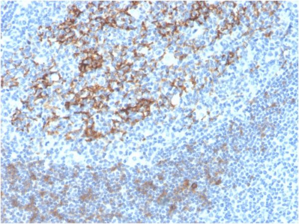 Formalin-fixed, paraffin-embedded human tonsil stained with CD23 Recombinant Rabbit Monoclonal Antibody (FCER2/4395R).