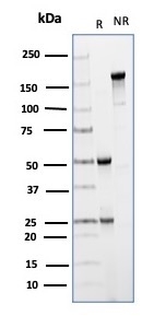 SDS-PAGE Analysis Purified CD64 Mouse Monoclonal Antibody (FCGR1A/6887). Confirmation of Integrity and Purity of Antibody.