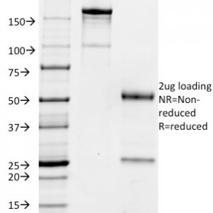 SDS-PAGE Analysis of Purified CD32 Mouse Monoclonal Antibody (FCGR2A/479). Confirmation of Purity and Integrity of Antibody.