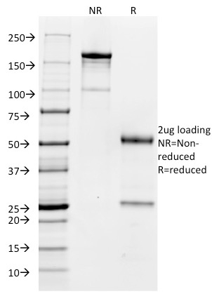 SDS-PAGE Analysis of Purified CD32 Mouse Monoclonal Antibody (FCGR2A/479). Confirmation of Purity and Integrity of Antibody.