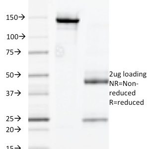 SDS-PAGE Analysis of Purified CD32 Mouse Monoclonal Antibody (7.30). Confirmation of Purity and Integrity of Antibody.