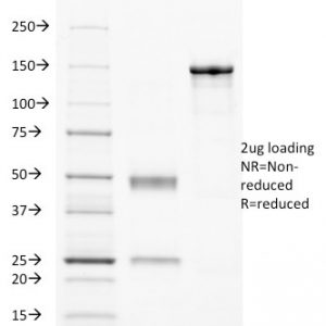 SDS-PAGE Analysis of Purified CD32 Mouse Monoclonal Antibody (8.7). Confirmation of Purity and Integrity of Antibody.