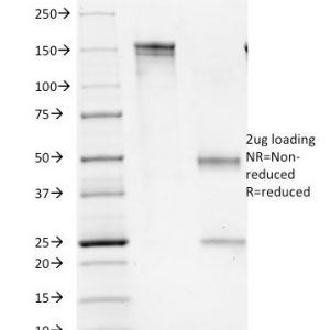 SDS-PAGE Analysis of Purified CD16 Mouse Monoclonal Antibody (C16/1045). Confirmation of Purity and Integrity of Antibody.