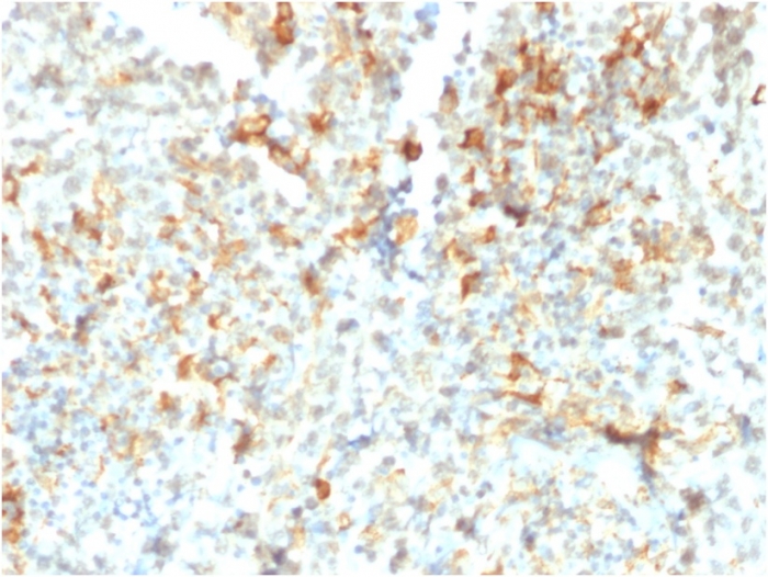 Formalin-fixed, paraffin-embedded human Testicular Cancer stained with FCGRT Mouse Monoclonal Antibody (FCGRT/2932). FCGRT / FcRn (IgG Transporter) Antibody - Image 2