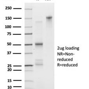 SDS-PAGE Analysis Purified FOXL1 Mouse Monoclonal Antibody (PCRP-FOXL1-1F8). Confirmation of Purity and Integrity of Antibody.