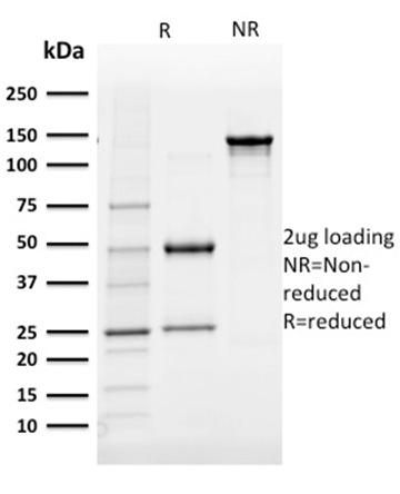 SDS-PAGE Analysis Purified AKR1B1 Mouse Monoclonal Antibody (CPTC-AKR1B1-3). Confirmation of Purity and Integrity of Antibody.