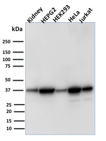 Western Blot Analysis of Human Kidney tissue, Human HepG2, HEK293, HeLa and Jurkat cell lysate using AKR1B1 Mouse Monoclonal Antibody (CPTC-AKR1B1-3).