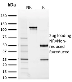 SDS-PAGE Analysis Purified AKR1B1 Mouse Monoclonal Antibody (CPTC-AKR1B1-2). Confirmation of Purity and Integrity of Antibody.
